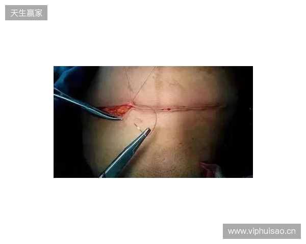 广州豹官方:杨浩眉弓伤口缝合30余针,预计5-7天后拆线 广州豹官方:杨浩眉弓伤口缝合30余针,预计5-7天后拆线